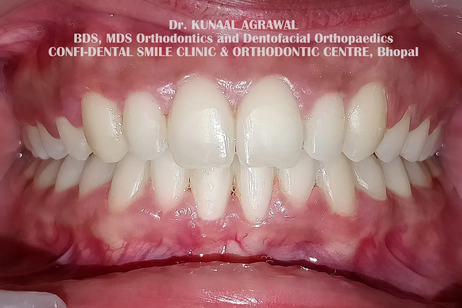 orthodonstis aligned