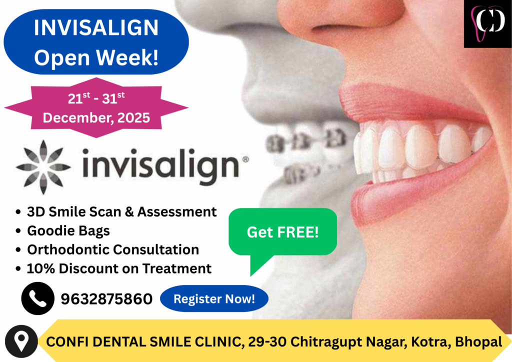 a poster inviting patients for their invisalign smile assessment and 3d intraoral scanning during invisalign open week scheduled to be conducted from 21st to 31st december, 2025, at confi dental smile clinic, bhopal