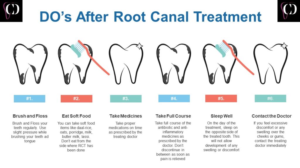 an instruction page showing things to be done by patients undergoing root canal treatment at confi dental smile clinic, bhopal