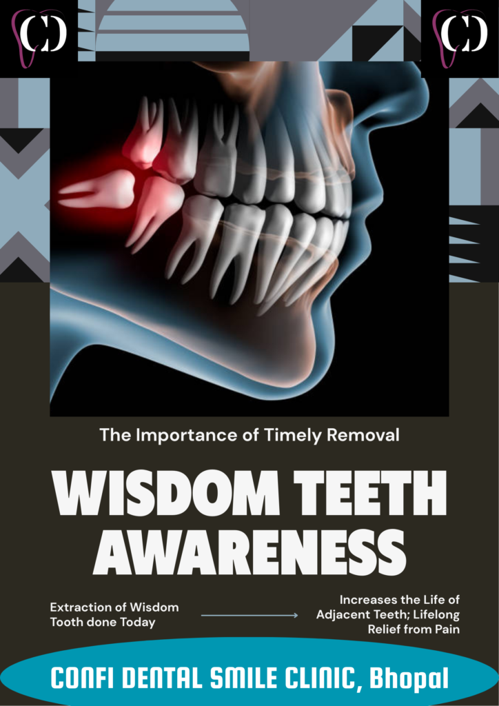 a poster showing the importance of timely removal of wisdom tooth at confi dental smile clinic, bhopal