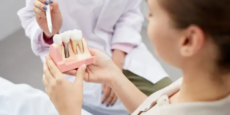 Best implant dentist Bhopal for dental implants