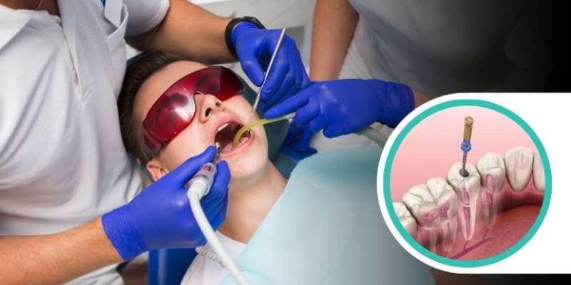 dentist root canal specialist
