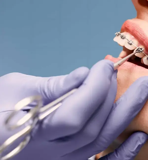Orthodontist adjusting braces during treatment
