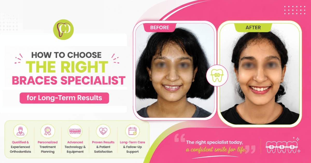 Braces specialist Bhopal