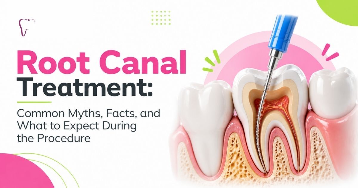root canal treatment