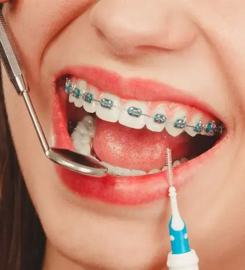 Braces care with dental cleaning tools